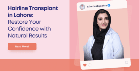 Hairline Transplant in Lahore